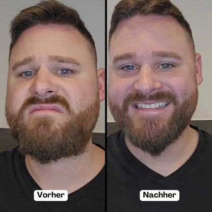 LonGlätter Pro- für Bart